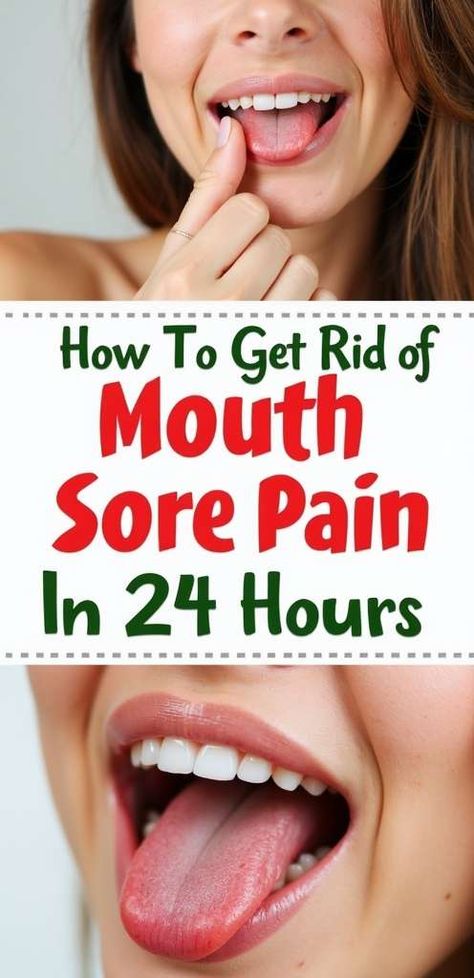 Say goodbye to mouth sore pain in just 24 hours!  Discover effective home remedies and expert tips that bring quick relief and promote healing. Dont let discomfort hold you backclick to learn how to soothe your mouth sores and get back to enjoying life!  #MouthSoreRelief #HealthTips #Wellness Mouth Sore, Innovative Products, Oral Health, Dental Care, Health Tips, Healing, Health