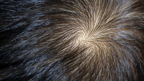 A hair whorl is a patch of hair growing in a circular pattern around a single point that is determined by the orientation of hair follicles. Deposit PhotosHair woes are universal—but hair whorls are unique. The post The swirls and whorls of your hairline come from multiple genes appeared first on Popular Science. Polygenic Inheritance, Mendelian Inheritance, Hair Whorl, Best Hair Care Products, Silver Foxes, Hair Growing, Hair Patterns, Hair Follicles, Popular Science