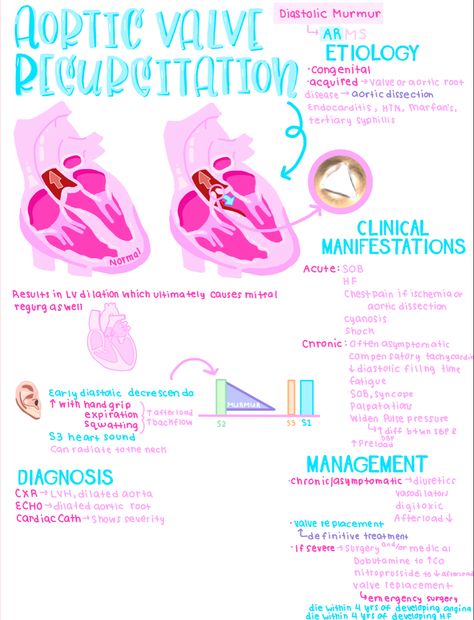 Pediatric Cardiac Sonography, Cardiac Pathology, Nursing Cardiovascular, Medical Study Notes, Medsurg Nursing, Pediatric Nursing Study, Nursing Printables, Physician Assistant Student, Cardiac Sonography