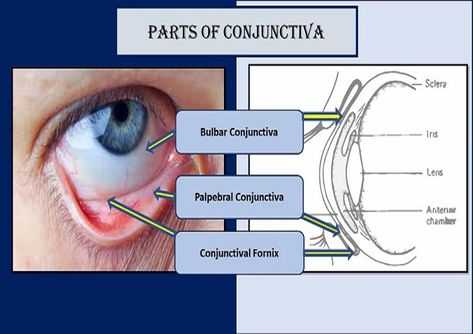 bulbar-palpebral-conjunctiva Conjunctiva Of Eye, Conjuctivita Eye, Optometry Education, Eye Anatomy, Medical Transcription, Nursing Life, Nursing School Motivation, Parts Of The Eye, Improve Nutrition