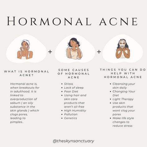 Hormonal acne is when breakouts form in adulthood that could range from blackheads and whiteheads to painful cysts. Hormonal acne is linked to the overproduction of sebum (an oily substance in skin glands), which clogs pores, leading to pimples. Though often unavoidable, hormonal acne can be treated to prevent future breakouts from forming. #hormonalacne #hormonalacnetreatment #hormonebalance #acne #acnesafeproducts #acnefacialtreatment #theskynsanctuary #esthetician #estheticianmeme #estheti... Treating Hormonal Acne, Hormonal Chin Acne, How To Heal Hormonal Acne, How To Clear Hormonal Acne, Esthetics Content, Hormonal Acne Skincare Routine, Period Pack, The Substance, Hormonal Acne Diet