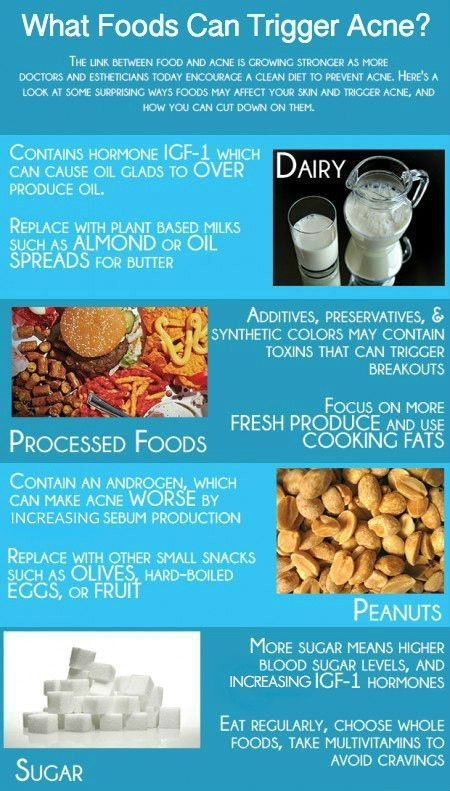 » What Foods Can Trigger Acne? Acne Holes, Clear Skin Overnight, Foods For Clear Skin, Acne Diet, Weight Gain Diet, Acne Prone Skin Care, Skin Facts, Acne Face Wash, Clean Diet