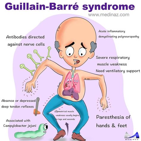 Diagnose it on Instagram: “Follow @medinaz_academy if you’re a visual learner. This page contains 1000+ hand drawn unique images which will be helpful for your exam…” Guillain Barre, Visual Learner, Guillain Barre Syndrome, Nursing School Essential, Medical School Life, Nursing School Motivation, Basic Anatomy And Physiology, Nurse Study Notes, Nursing Student Tips