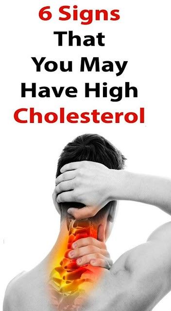 What Causes High Cholesterol, Cholesterol Symptoms, Cholesterol Test, High Cholesterol Levels, Clogged Arteries, Health Articles Wellness, Cholesterol Remedies, Cholesterol Lowering Foods, Lower Your Cholesterol