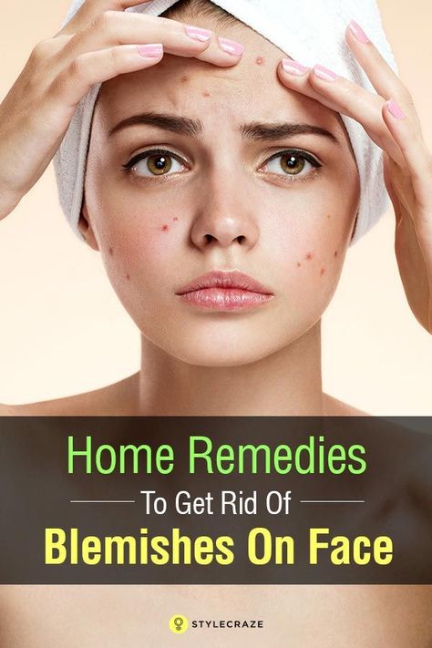 How To Get Rid Of Blemishes On Face, Blemishes On Face Remedies, Face Recipes, Blemishes On Face, Blemish Remedies, Gentle Face Scrub, Cystic Acne Remedies, Acne Home Remedies, Dry Skincare