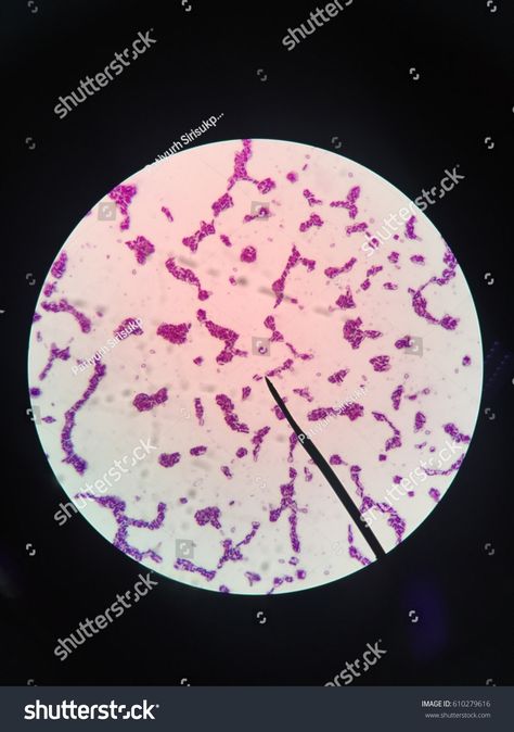 Clostridium botulinum,bacteria gram positive,microscope,science,bacteria,science lab,lab,biology,microbiology,cell,spore,toxin #Ad , #affiliate, #gram#positive#microscope#Clostridium Bacteria Under Microscope, Clostridium Botulinum, Icon Design Inspiration, Science Lab, Creative Icon, Microbiology, Icons Design, Biology, Icon Design