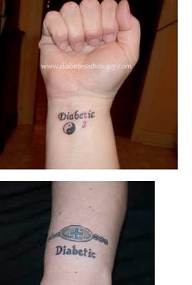 Diabetic Tattoo Blood Type Tattoo, Medical Alert Tattoo, Dog Tags Tattoo, Medical Tattoo, Type Tattoo, Inkbox Tattoo, Foot Tattoo, Chronic Condition, Tattoo Removal