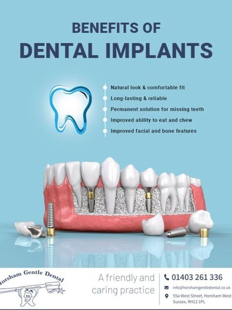 Benefits Of Dental Implants, Dental Implants Poster, Dental Implants Advertising, Dental Implant Poster, Dentist Post Ideas, Dental Clinic Wallpaper, Dental Posters For Clinic, Dental Clinic Poster, Dental Advertisement