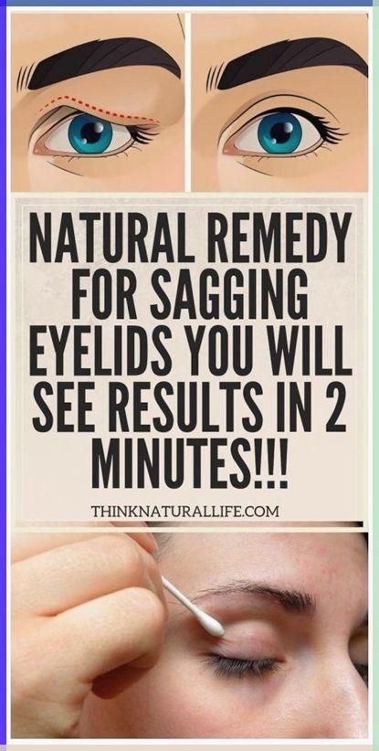 Gratitude for the valuable | Skin Care Remedies | Nature | Saggy Eyelids | Droopy Eyelids Healthy Checklist, Skincare For Redness, Skincare For Wrinkles, Saggy Eyelids, Eye Health Remedies, Sagging Eyelids, Eye Care Tips, Dark Spots Remedies, Eye Diseases