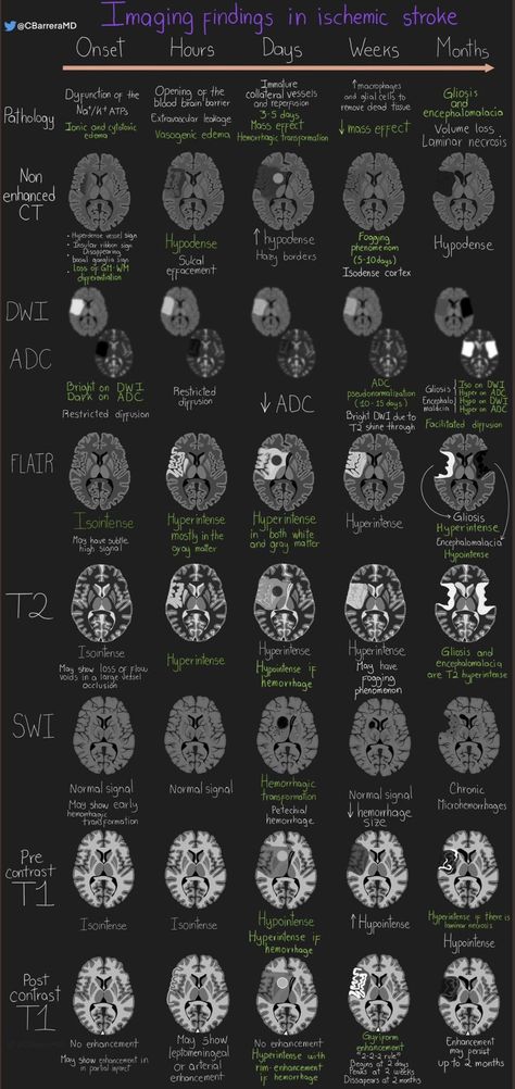 Medical Radiography, Med School Study, Radiology Student, Radiology Technician, Radiology Imaging, Medical School Life, Basic Anatomy And Physiology, Medicine Studies, Medical Student Motivation