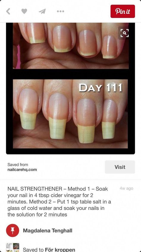 Find out how to boost your nails' growth rate with these simple tricks. Nails Grow Faster, Grow Long Nails, Nail Growth Tips, Grow Nails Faster, Nagel Tips, Nail Care Routine, Nail Care Tips, How To Grow Nails, Nail Growth