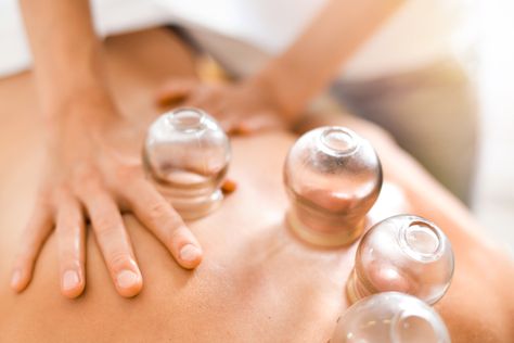 Benefits Of Cupping, Massage Cupping, Cupping Massage, Cupping Therapy, Integrative Medicine, Olympic Athletes, Muscle Aches, Deep Tissue Massage, Traditional Chinese Medicine