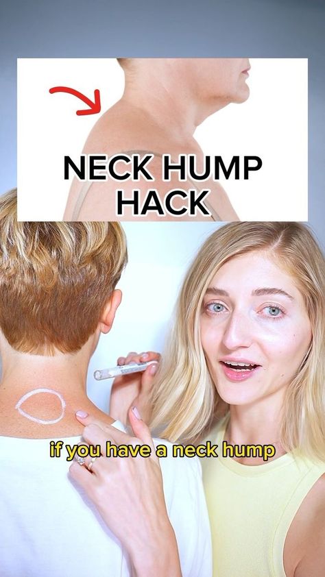 Loose Weight Workout, Forward Head Posture Exercises, Better Posture Exercises, Neck Hump, Face Fitness, Neck And Shoulder Muscles, Forward Head Posture, Face Yoga Facial Exercises, Lower Back Pain Exercises