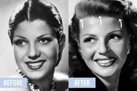 Hairline Laser Hair Removal, Rita Hayworth Before And After, Hairline Lowering Surgery, Classic Beauty Icons, Rita Hayworth Hair, Marilyn Monroe Plastic Surgery, Old Hollywood Beauty, 50s Beauty, Old Hollywood Makeup