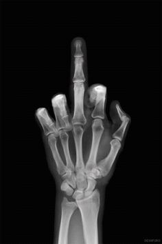 1000+ ideas about Iphone Wallpaper Black on Pinterest Middle Finger Wallpaper, Xray Art, I Hate Love, Medical Wallpaper, Black And White Aesthetic, Skull And Bones, X Ray, Black Wallpaper, Android Wallpaper