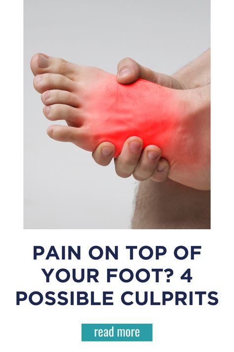 Pain on Top of Your Foot? 4 Possible Culprits Sore Ankle Remedies, Neuropathic Foot Pain Relief, Top Of Foot Pain, Sore Feet Relief, Foot Pain Chart, Foot Pain Relief Remedies, K Tape, Arthritic Pain, Broken Foot