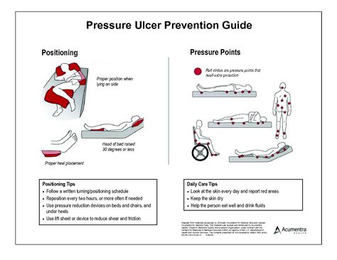 keep on turning! Pressure Injury Prevention Posters, Pressure Ulcer Prevention Poster, Pressure Injury Prevention, Pressure Ulcer Prevention, Pressure Ulcer Staging, Pressure Injury, Wound Care Nursing, Nurse Brain Sheet, Nursing Fun