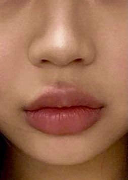 Desire Face Ideas, Heavy Lower Lip Shape, Round Lips Shape, Narrow Lower Face, Small Round Lips, Upturned Lips Corners, Small Plump Lips, Bigger Bottom Lip, No Cupid Bow Lips