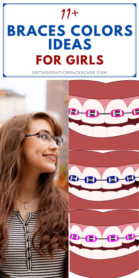 Best Braces Colors Ideas For Girls Teeth Best Colors To Get For Braces, Braces Rubber Bands Colors, Colors For Braces Ideas, The Best Colors For Braces, Cute Braces Colors Combinations, Spring Braces Colors, What Braces Color Should I Get Quiz, Rubber Band Colors For Braces, Metal Braces Colors