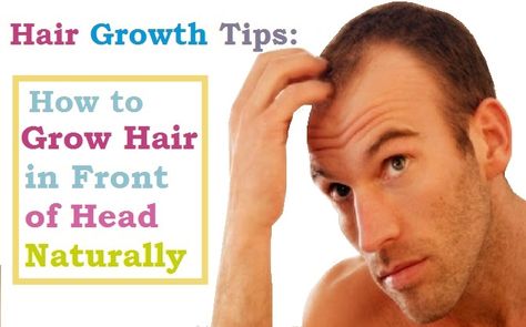 Hair loss can be really distressing, so it is natural that you want to improve your hair if it’s not to your satisfaction. You have several options to re-grow your hair. Try some of these natural remedies to stimulate hair growth. It is recommended to consult your doctor before taking supplements.Hair growth tips: How to grow hair in front of the head naturallyHow to Make Your Hair Grow Faster:  Natural Remedies and Medical ProceduresHair LossHair consists of the keratin mate How To Grow Your Front Hair Faster, Grow Hair Back, Regrow Lost Hair, Ways To Grow Hair, Make Your Hair Grow Faster, How To Grow Hair, Natural Hair Regrowth, Hair Grow Faster, Medical Procedures