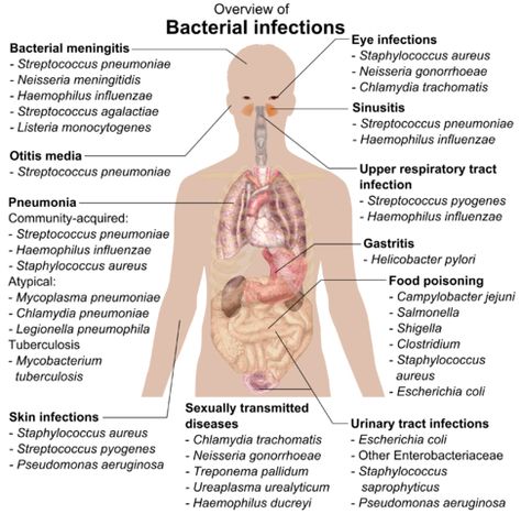 Difference Between Upper Respiratory Infection and Bronchitis Upper Respiratory Infection, Parasite Cleanse, Pharmacy School, Nursing School Notes, Respiratory Infection, Medical Coding, Nursing Tips, Medical Laboratory, Bacterial Infection