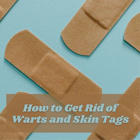 Removing Warts On Face, Wart Remover Diy, How To Get Rid Of Warts On Face, Remove Skin Tags Naturally Apple Cider, Skin Tags How To Get Rid Of Diy, Get Rid Of Skin Tags Fast, Skin Tags Removal Overnight How To Get Rid, How To Get Rid Of Skin Tags Fast, Natural Ways To Remove Skin Tags