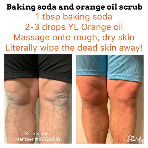 Scrub those nasty, dry, ashy knees and elbows away with Young Living orange oil. Orange oil is great for cleansing, cleaning, and so many other things. Young Living Orange, Ashy Knees, Orange Oil, Try Not To Laugh, Young Living, Dead Skin, Clear Skin, Dry Skin, Scrubs