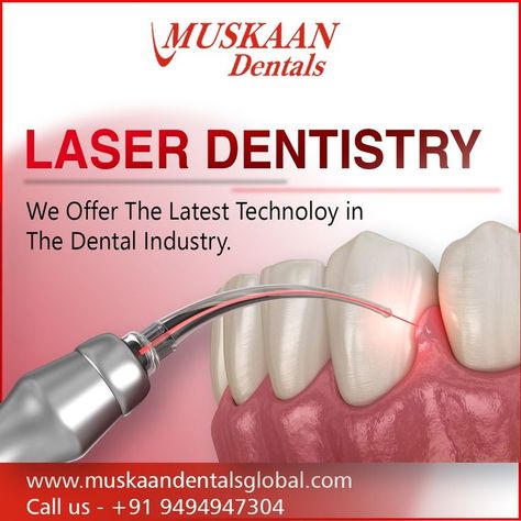 Dental Laser, Dental Advertising, Laser Dentistry, General Dentistry, Metal Tools, Creative Ads, Dental Clinic, Oral Health, Dental Care