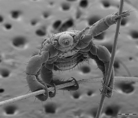 NBC News Electron Microscope Images, Under Microscope, Scanning Electron Microscope, Microscopic Photography, Micro Photography, Head Louse, Microscopic Images, Electron Microscope, Microscopes