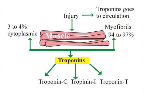 Troponin levels in nursing Troponin Levels, What Is Normal, Acute Coronary Syndrome, Lung Infection, Parts Of The Heart, Cardiac Nursing, Developmental Stages, Heart Muscle, Skeletal Muscle