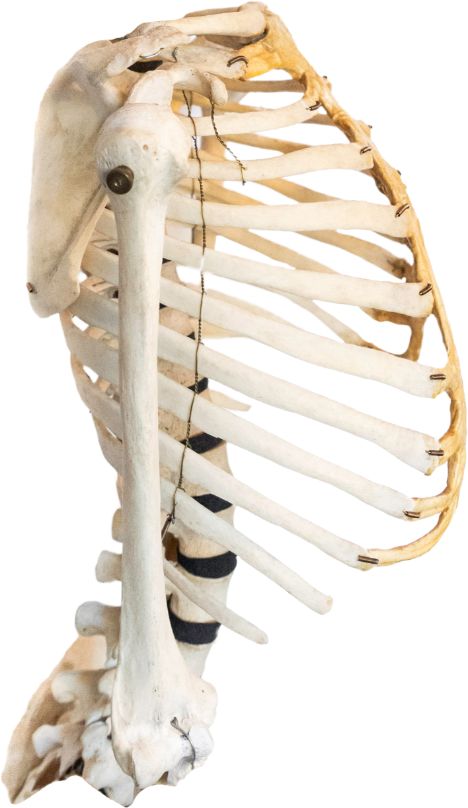 Rib Cage Reference, Cage Reference, Wide Rib Cage, Ulna Bone, Scapula Bone, Radius Bone, Human Ribs, Human Rib Cage, Tooth Nerve