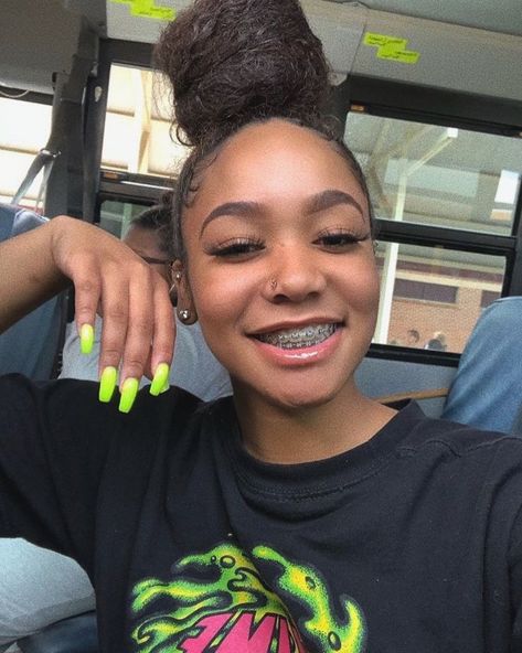 pinterest : @dabratzbby ‘ 🤍 follow for more pins! ✨ #braces Braces, A Woman, Nail Polish, Neon, Nails, Green