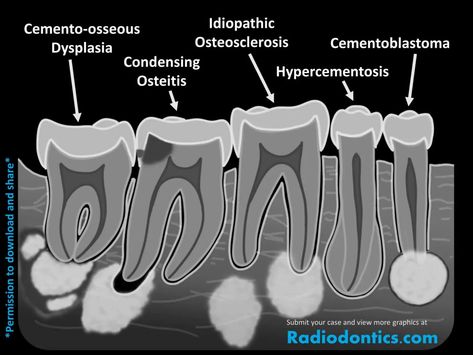 Dental Radiology, Dentist Career, Dental Hygienist School, Tooth Health, Soap Notes, Dental Images, Dental Posters, Dental Hygiene School, Dentistry Student