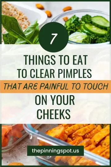 Wondering what toeat for clear skin. Here are 7 foods good for skin. Tese foods get rid of acne super fast from the inside. They are foods I eat for pimple free skin. If you want to learn how to get rid of pimples on cheeks, forehead, that arepainful, read more what to eat for clear skin | foods good for skin | foods to get rid of acne | meals good for acne prone skin | acne friendly meals | foods for pimple fre skin | pimple clearing | ow to get rid of pimples | clear painful pimples on cheeks Foods Good For Skin, Eat For Clear Skin, Cheek Pimples, Acne Drink, Cheek Acne, Clear Pimples, Painful Pimple, Best Foods For Skin, Pimples On Forehead