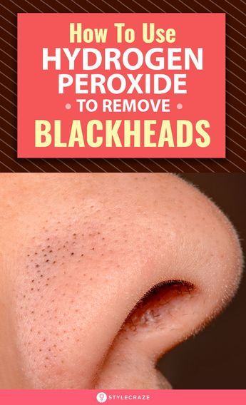 Fitness Hacks, Blackheads On Nose, To Remove Blackheads, Ootd Instagram, Cold Sores Remedies, Remove Blackheads, Natural Sleep Remedies, Get Rid Of Blackheads, Cold Home Remedies