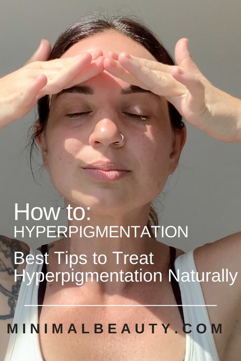 What Is Hyperpigmentation, Skin Care Routine Hyperpigmentation, How To Treat Hyperpigmentation, Clearing Hyperpigmentation, Hyperpigmentation Remedies, Hyperpigmentation Mask, Removing Hyperpigmentation, Scar Healing, Hormone Nutrition