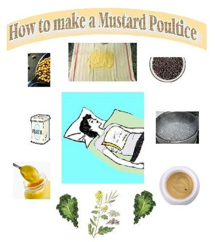 MUSTARD POULTICE OR PLASTER - The true home remedy for the flu, colds – Kerstin's Nature Products For People And Pets Pneumonia Remedies, Mustard Plaster, Remedy For Sinus Congestion, Chest Congestion Remedies, Congestion Remedies, Home Remedies For Sinus, Home Remedies For Bronchitis, Sinus Congestion Relief, Respiratory Disease