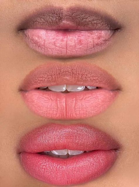 How To Lighten Dark Lips Permanently, Lip Blush On Dark Lips, Lip Blushing Tattoo Colors Dark Skin, Natural Lip Blushing, Lip Hyperpigmentation, Lip Color Tattoo, Skin Types Chart, Lip Pigmentation, Lighten Dark Lips