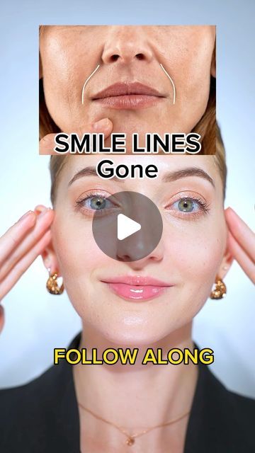 572K views · 31K likes | Valeriia Veksler Face Fitness Nurse on Instagram: "Smile lines face yoga   Do each exercise daily along with me Save to remember💛  #faceyoga #smilelines #nasolabialfolds #facefitness #beautyroutine   Disclaimer: not a medical advice. For education purpose only. Consult with your physician if you have a medical condition." Face Fitness, Exercise Daily, Nasolabial Folds, Smile Lines, Face Exercises, Face Yoga, Medical Advice, Beauty Routines, Medical