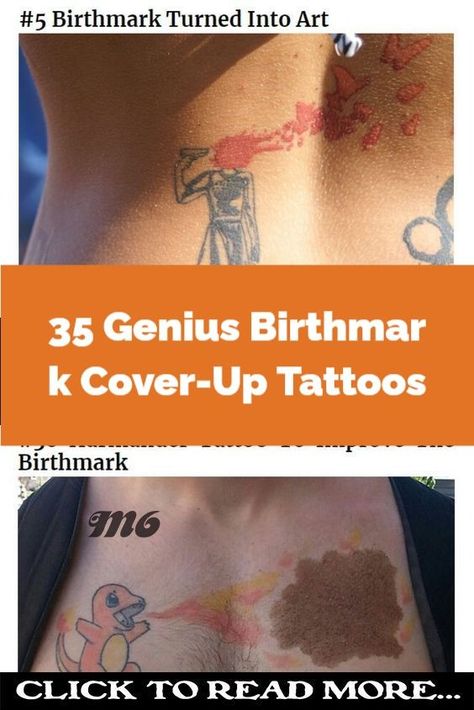 35 Genius Birthmark Cover-Up Tattoos Birthmark Tattoo, Lower Abs, Cover Up Tattoos, Self Conscious, Much Needed, Self Confidence, Helping People, Cover Up, Turn Ons