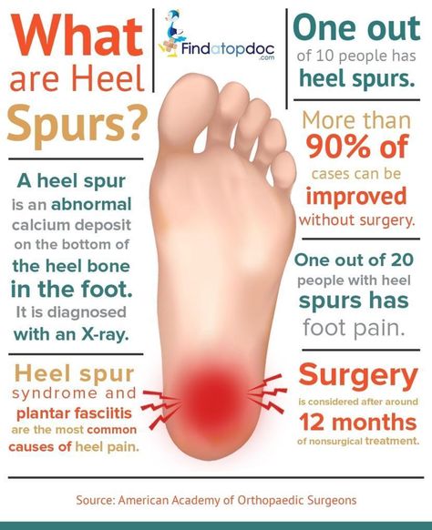 What is a Heel Spur? Heal Spur Remedies, Heal Spurs, Heel Spur Relief, Facitis Plantar, Foot Pain Relief Remedies, Heel Spur, Heel Pain Relief, Pain Relief Remedies, Foot Exercises