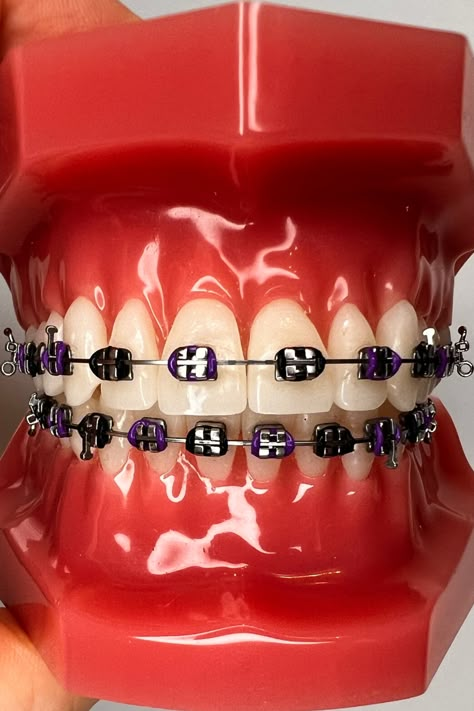 Dark Purple Braces, Black Braces Bands, Colored Braces, Purple Braces, Braces Colors Combinations, Braces Ideas, Pink Braces, Green Braces, Red Braces