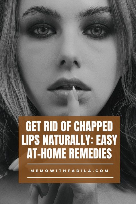 #ChappedLips #LipCare #HydratedLips #DryLipsRelief #LipMoisturizer #SoftLips #LipCareRoutine #LipBalm #HealthyLips #LipHydration #WinterLips #LipTreatment #SootheChappedLips #LipRepair #LipCareTips Dry Lips Remedy Diy, Dry Cracked Lips Remedy, How To Get Rid Of Chapped Lips Fast, How To Heal Dry Cracked Lips, Chapped Lips Remedy Severe, Lips Remedies, Dry Lips Remedy, Bigger Lips Naturally, Lip Peeling