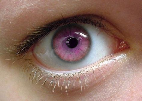 Pink Eye Color, Rare Eye Colors, Kaleidoscope Eyes, Rare Eyes, Birth Colors, Football Camp, Eyes Color, Eye Eye, Pink Eye