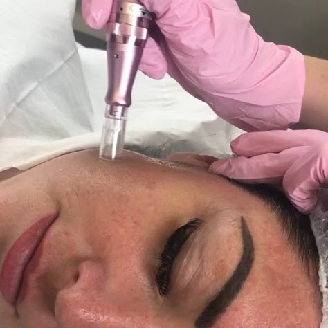 Dermapen Microneedling, Derma Facial, Medical Esthetician, Derma Pen, Beauty Therapy, Derma Roller, Beauty Industry, Esthetician, Facial Skin