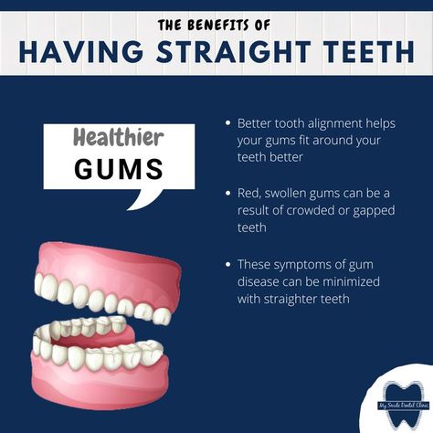 Teeth Straight, Toothache Remedies, Dental Content, Dentist Branding, Teeth Alignment, Remedies For Tooth Ache, Dental Posters, Swollen Gum, Dental Fun