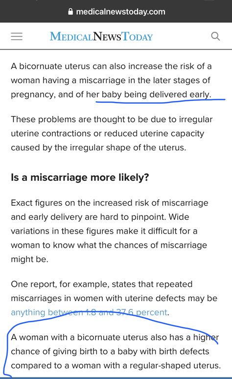 Bicornuate Uterus Pregnancy, Bicornuate Uterus, Pregnancy Stages, Quick Saves, Stages Of Pregnancy