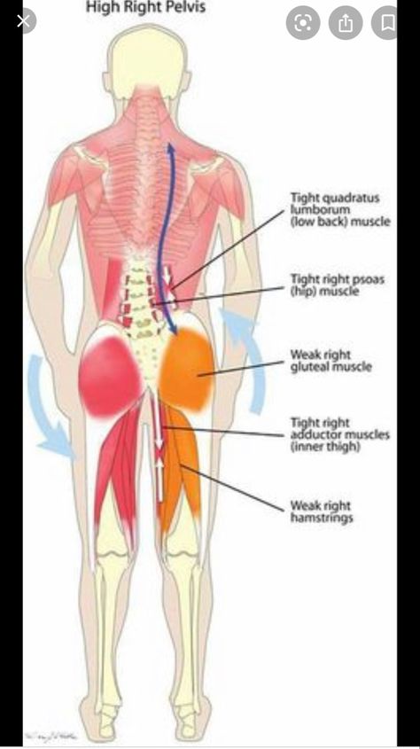 Misaligned Pelvis, Punkty Spustowe, Tight Hip Flexors, Muscle Imbalance, Spine Health, Muscle Anatomy, Simple Health, Hip Muscles, Back Pain Exercises