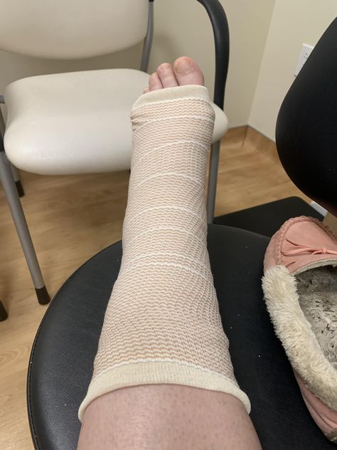 I frequently note that stairs are not my friend. Just to prove it, when going upstairs to bed last night I managed to break and sprain my left ankle and foot. Urgent Care in Buellton has referred me to an orthopedist. Hopefully I’ll get in soon. 😣 Ankle Sprain, Sprained Ankle, Urgent Care, Prove It, Last Night, My Friend, Stairs, Bed, Quick Saves