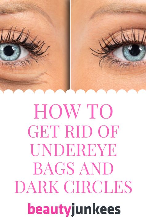 Concealer For Under Eye Bags, Dark Undereyes How To Get Rid Of, Cover Up Eye Bags, How To Cover Up Eye Bags, How To Reduce Bags Under Eyes, How To Cover Bags Under Eyes, How To Get Ride Of Bags Under Eyes Fast, How To Cover Under Eye Bags, How To Conceal Under Eye Bags Over 50